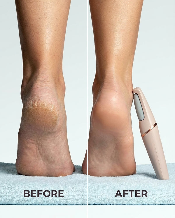 With SilkSR Pro you get: